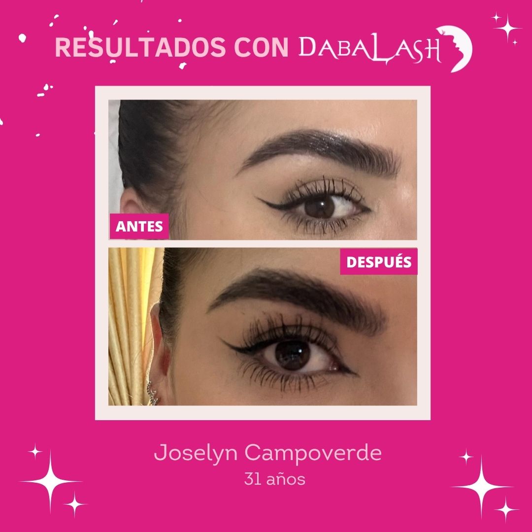 Testimonios de crecimiento de pesta&ntilde;as 